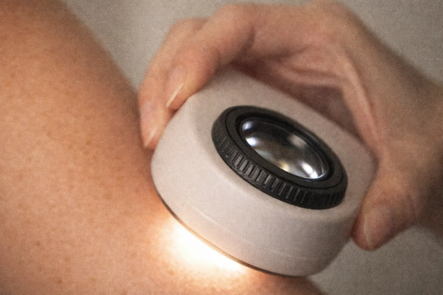 Dermoscopie en cours — examen de la peau au dermatoscope